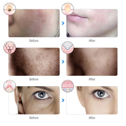 Facial Rejuvenation Mask