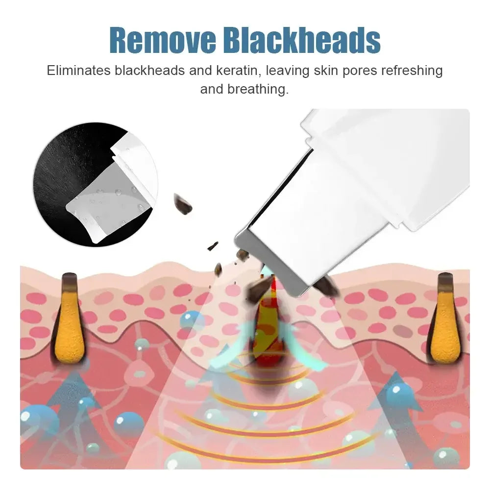 Vibraluxe Deep Skin Scrubber